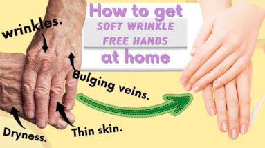 How to Stop AGING HANDS, Reduce Wrinkles, Dry, Thinning skin/ Hand Massages and Home remedies