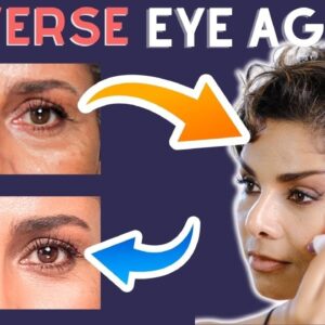 Dont Let EYE WRINKLES age you: Try Age Defying FACE YOGA and NATURAL REMEDIES