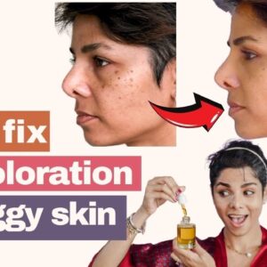 3 At Home Remedies to Correct DISCOLORATION n and Prevent Face from SAGGING