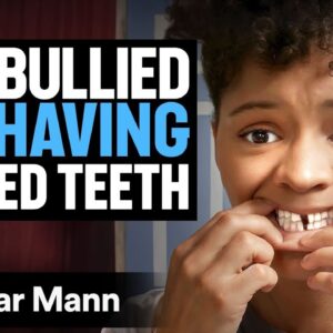 Girl Bullied For Having GAPPED TEETH | Dhar Mann Studios