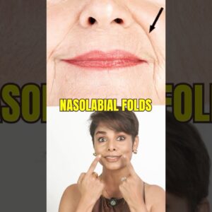No cream works like this NASOLABIAL FOLD skincare solution/ #laughlines