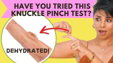 Remedies for Aging KNUCKLES: Make your HANDS Look 10 yrs YOUNGER
